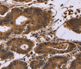 EDN2 Polyclonal Antibody - 3