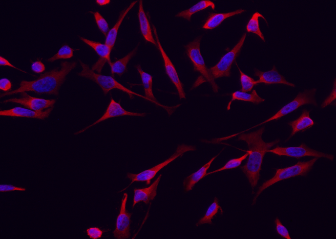 RRM1 Monoclonal Antibody - small - 2