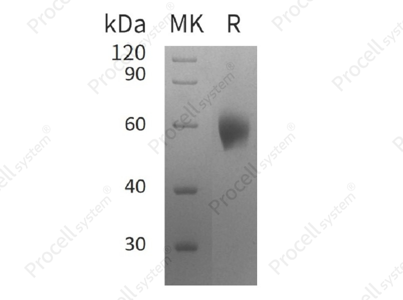 IL-1RAcP/IL-1R3/IL-1F6 (C-6His), Human, Recombinant