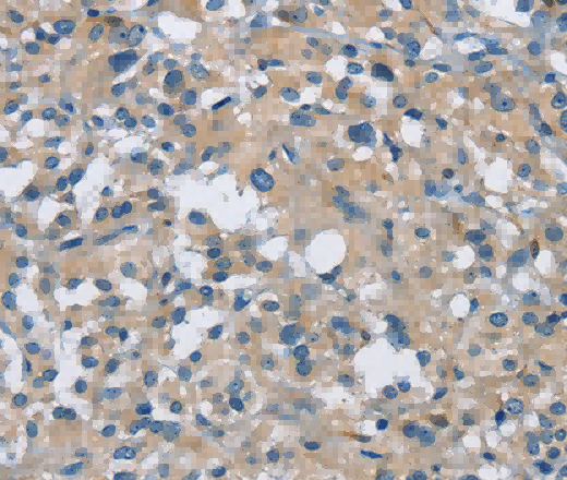 CAB39L Polyclonal Antibody - 3