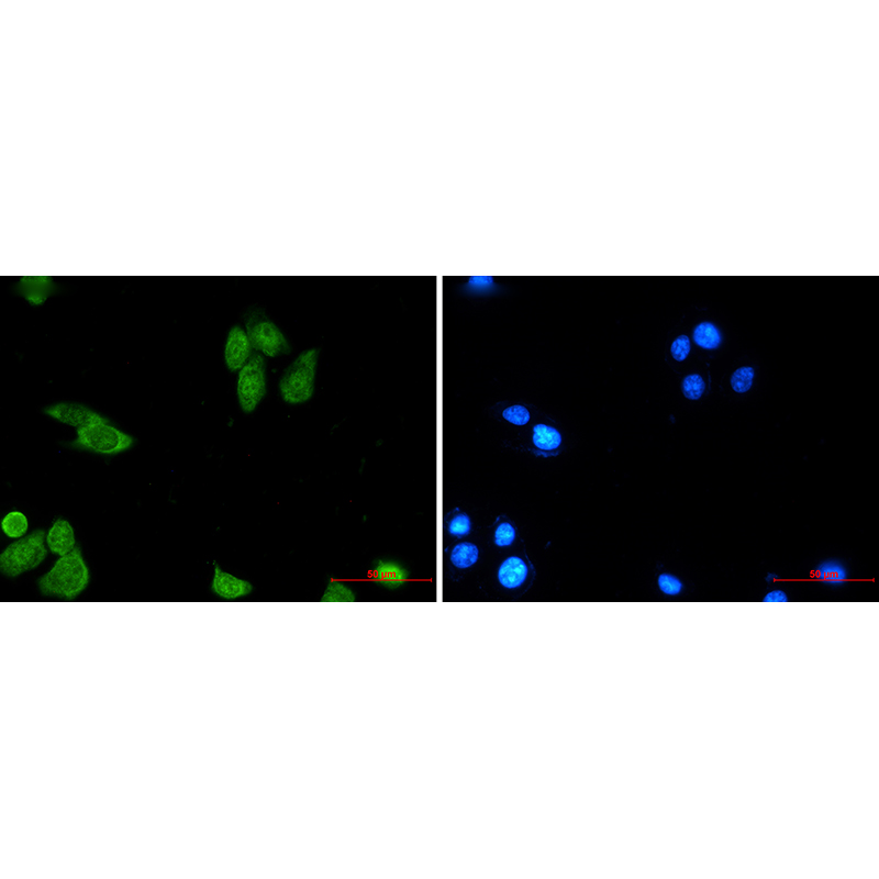 Immunofluorescence of Survivin (green) in MCF-7 using Survivin antibody at dilution 1:20, and DAPI(blue)