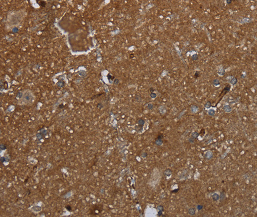 GALT Polyclonal Antibody - small - 3