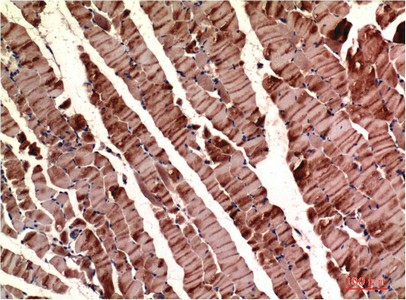 Immunohistochemistry of paraffin-embedded Mouse skeletal muscle tissue using ACTA1 Monoclonal Antibody at dilution of 1:200.