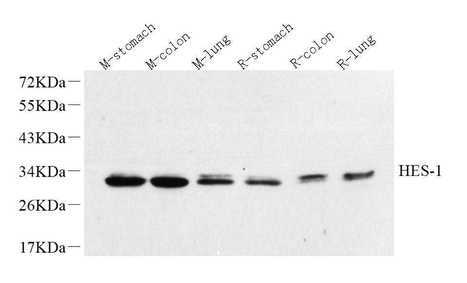 Western Blot analysis of various samples using HES1 Polyclonal Antibody at dilution of 1:600.