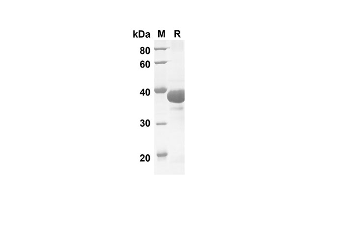Recombinant Human IL17D Protein(Sumo Tag)-1