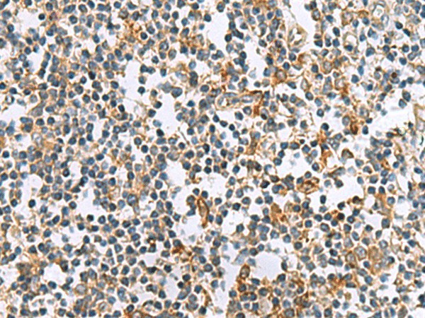 Immunohistochemistry of paraffin-embedded Human tonsil tissue  using GUCA1A Polyclonal Antibody at dilution of 1:105(?200)