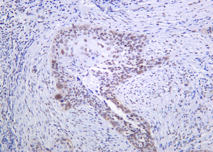Recombinant SRSF2 Monoclonal Antibody-searchlist-1
