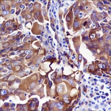 Recombinant FASN Monoclonal Antibody - 3