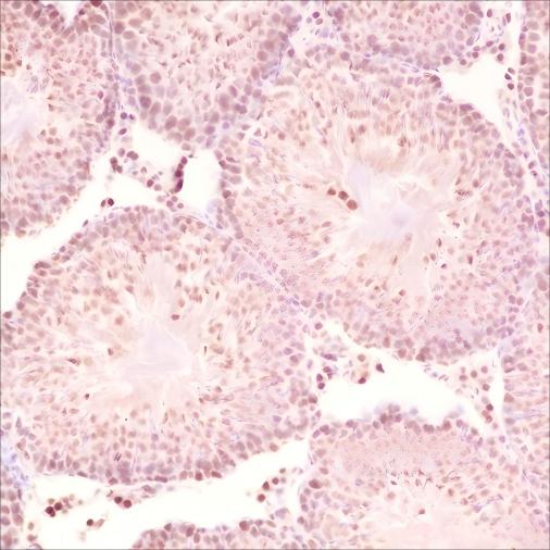 Recombinant SF1 Monoclonal Antibody - small - 4