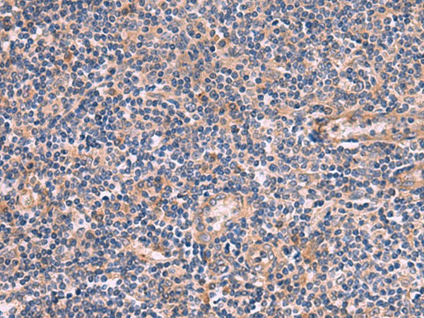 Immunohistochemistry of paraffin-embedded Human tonsil tissue  using ARIH2 Polyclonal Antibody at dilution of 1:80(?200)