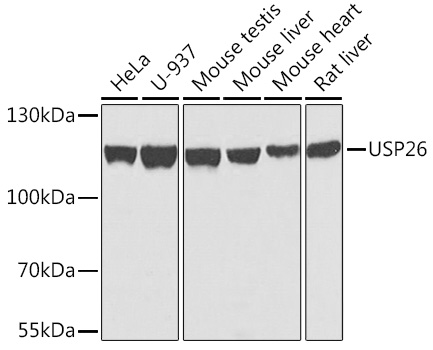 Western blot analysis of extracts of various cell lines using USP26 Polyclonal Antibody at 1:1000 dilution.