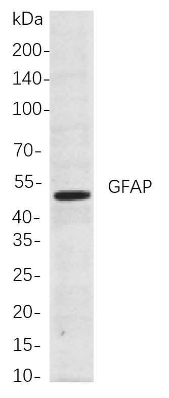 Recombinant GFAP Monoclonal Antibody-searchlist-1