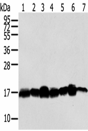 Western Blot analysis of Hela, NIH/3T3, LNCap and 293T cells, Mouse brain tissue, A549 and Jurkat cells  using NME2 Polyclonal Antibody at dilution of 1/300