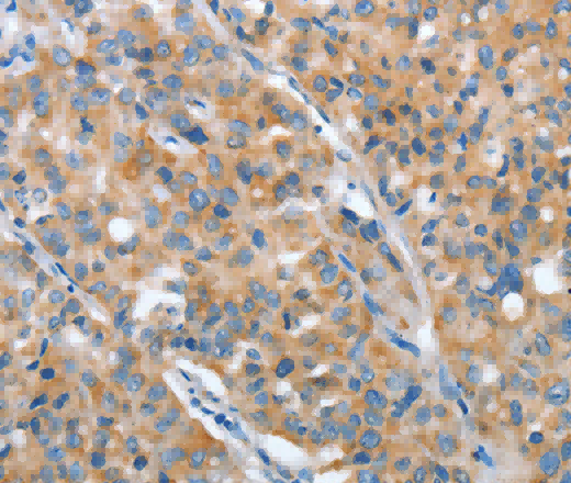 ARFGAP1 Polyclonal Antibody - 2