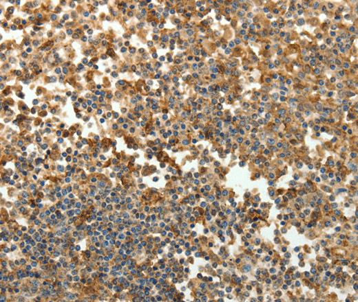 Immunohistochemistry of paraffin-embedded Human tonsil tissue using SFTPD Polyclonal Antibody at dilution 1:30