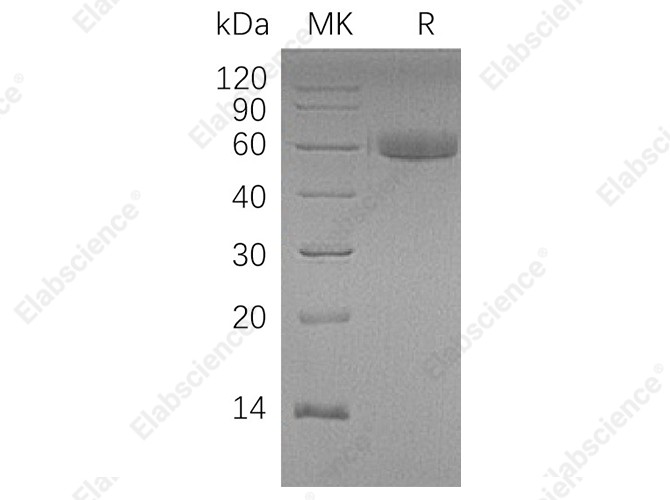 Recombinant Human HAO1 Protein (His Tag) - 1