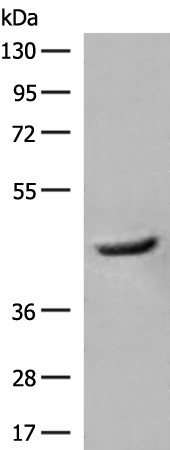 Western blot analysis of Human fetal liver tissue lysate  using GCAT Polyclonal Antibody at dilution of 1:400