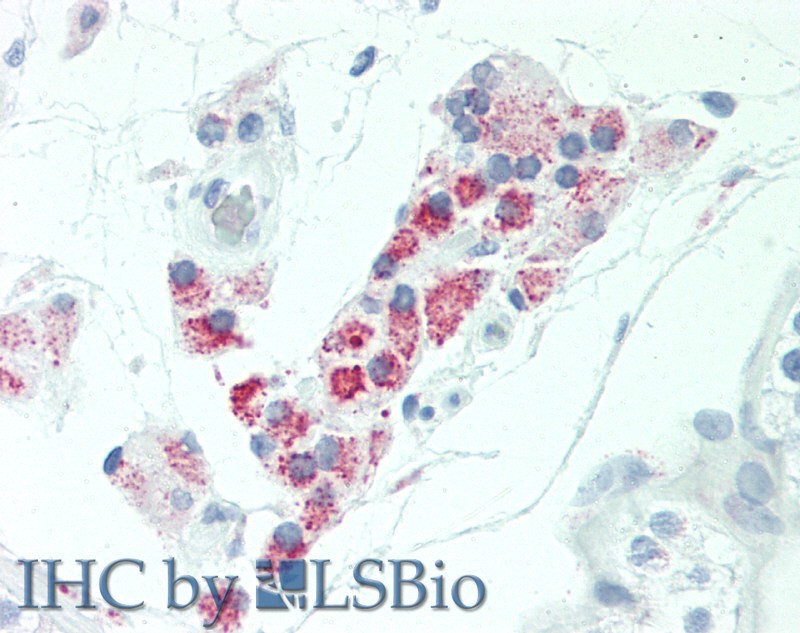 Immunohistochemistry of paraffin-embedded Human Testis, Leydig Cells using HSD17B8 Polyclonal Antibody at dilution of 1:100(Elabscience Product Detected by Lifespan).