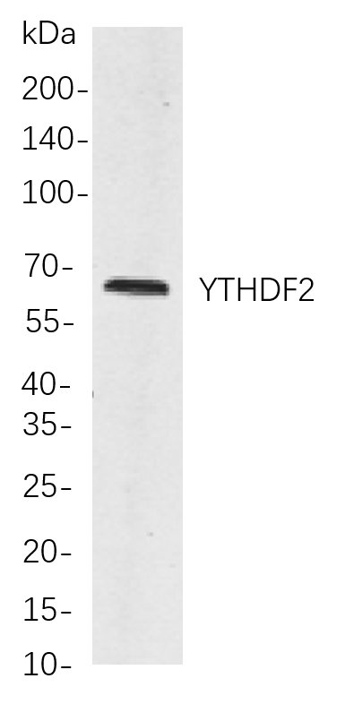 Recombinant YTHDF2 Monoclonal Antibody-searchlist-1