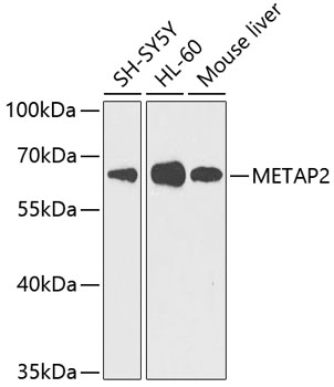 Western blot analysis of extracts of various cell lines using METAP2 Polyclonal Antibody at dilution of 1:1000.