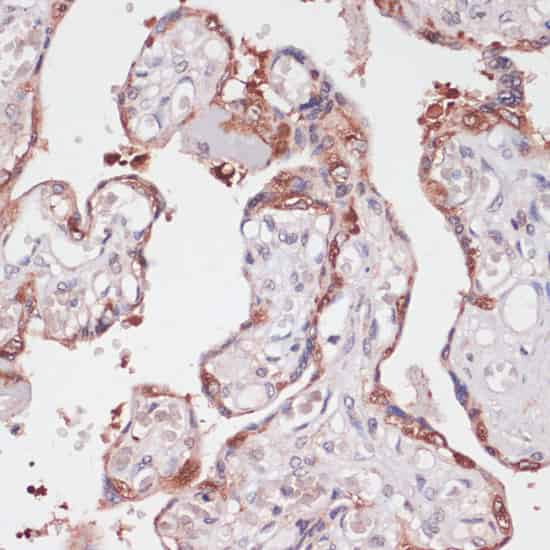 Immunohistochemistry of paraffin-embedded Human placenta using TPD52 Polyclonal Antibody at dilution of 1:100 (40x lens).