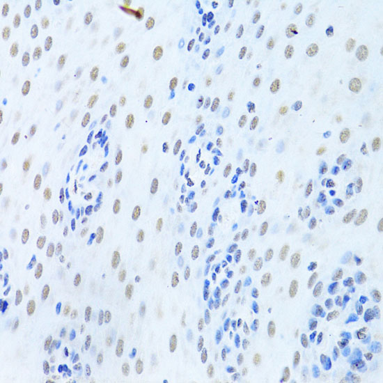 Immunohistochemistry of paraffin-embedded Human esophagus using HNRNPK Polyclonal Antibody at dilution of 1:200 (40x lens).