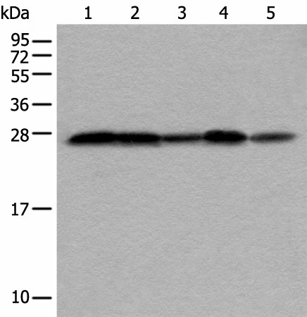 Western blot analysis of HEPG2 Hela Jurkat 231 and HUVEC cell lysates  using VTI1A Polyclonal Antibody at dilution of 1:350