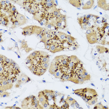 Immunohistochemistry of paraffin-embedded Human stomach using CHIC2 Polyclonal Antibody at dilution of  1:100 (40x lens).