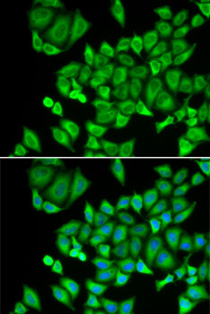 Immunofluorescence analysis of U2OS cells using DHRS9 Polyclonal antibody. Blue: DAPI for nuclear staining.