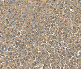 RNH1 Polyclonal Antibody - 3