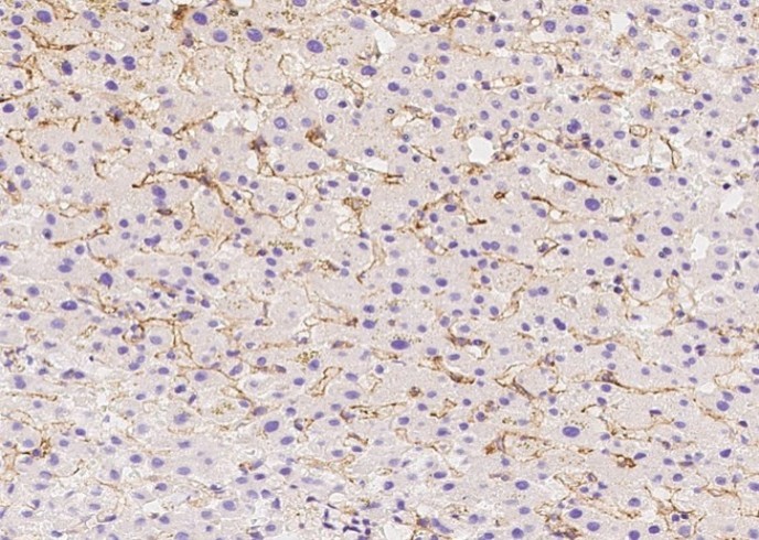 Endoglin/CD105 Monoclonal Antibody - small - 3