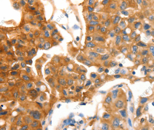 MVP Polyclonal Antibody - 2