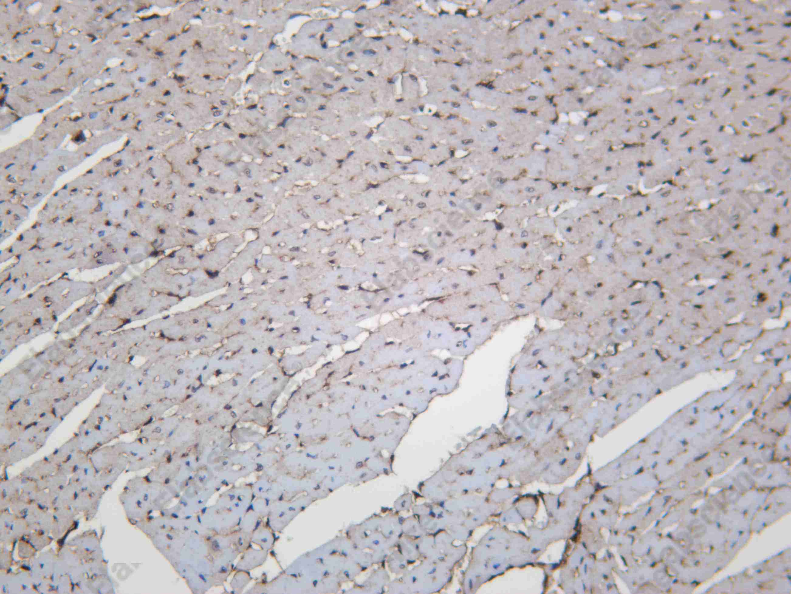 Recombinant VPS4A Monoclonal Antibody - 2