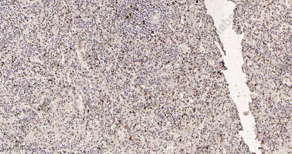 Recombinant PCNA Monoclonal Antibody - 2