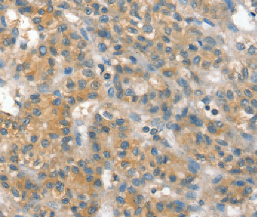 PPP2CA Polyclonal Antibody - 3