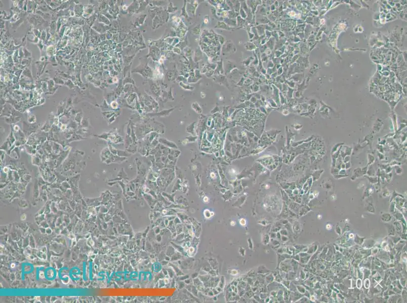 OV-90 Cell Complete Medium - 1