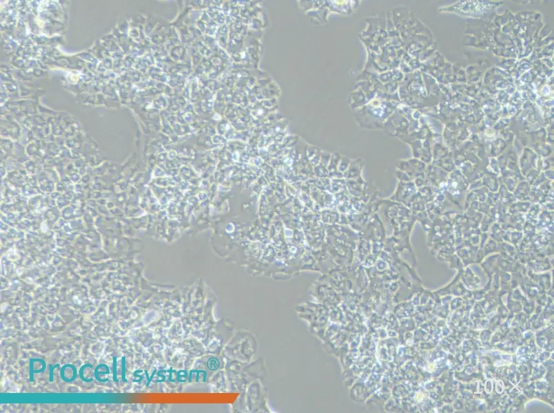 MUG-Chor1 Cell Complete Medium - 1
