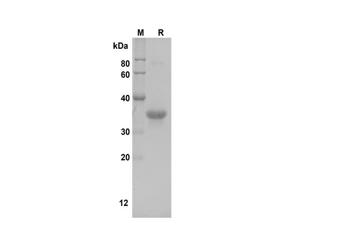 Recombinant Human MCSF Protein(GST Tag)-1