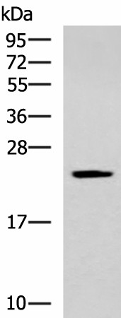 Western blot analysis of Human fetal liver tissue lysate  using CMPK1 Polyclonal Antibody at dilution of 1:700