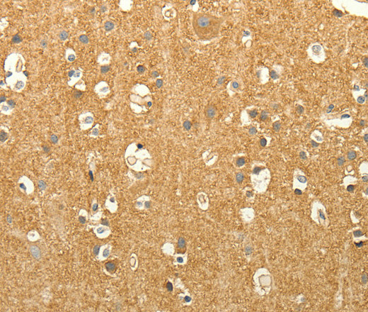 Immunohistochemistry of paraffin-embedded Human brain tissue using EDG7 Polyclonal Antibody at dilution 1:40