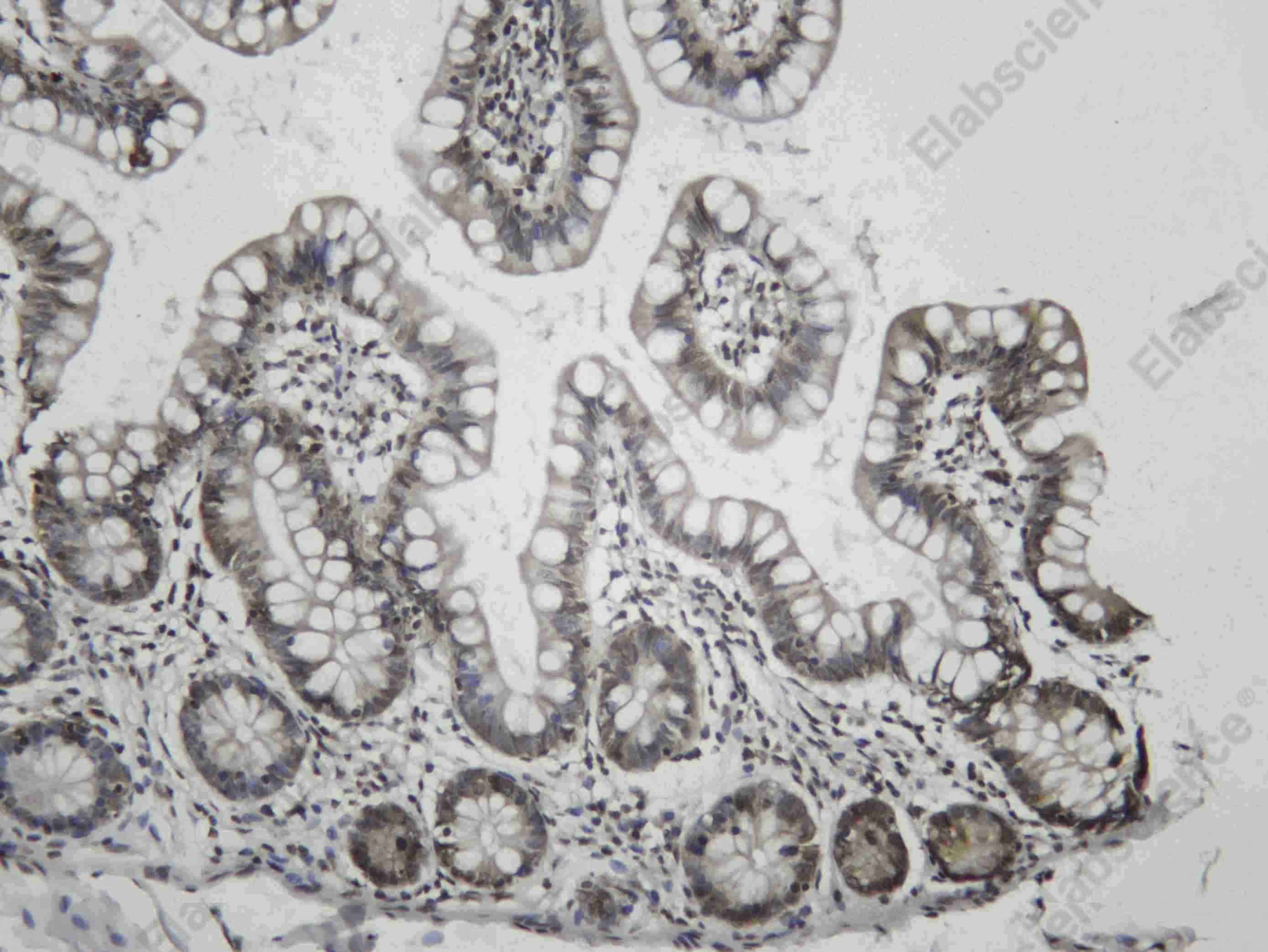 Recombinant Histone H4 (Mono Methyl Lys20) Monoclonal Antibody - 1