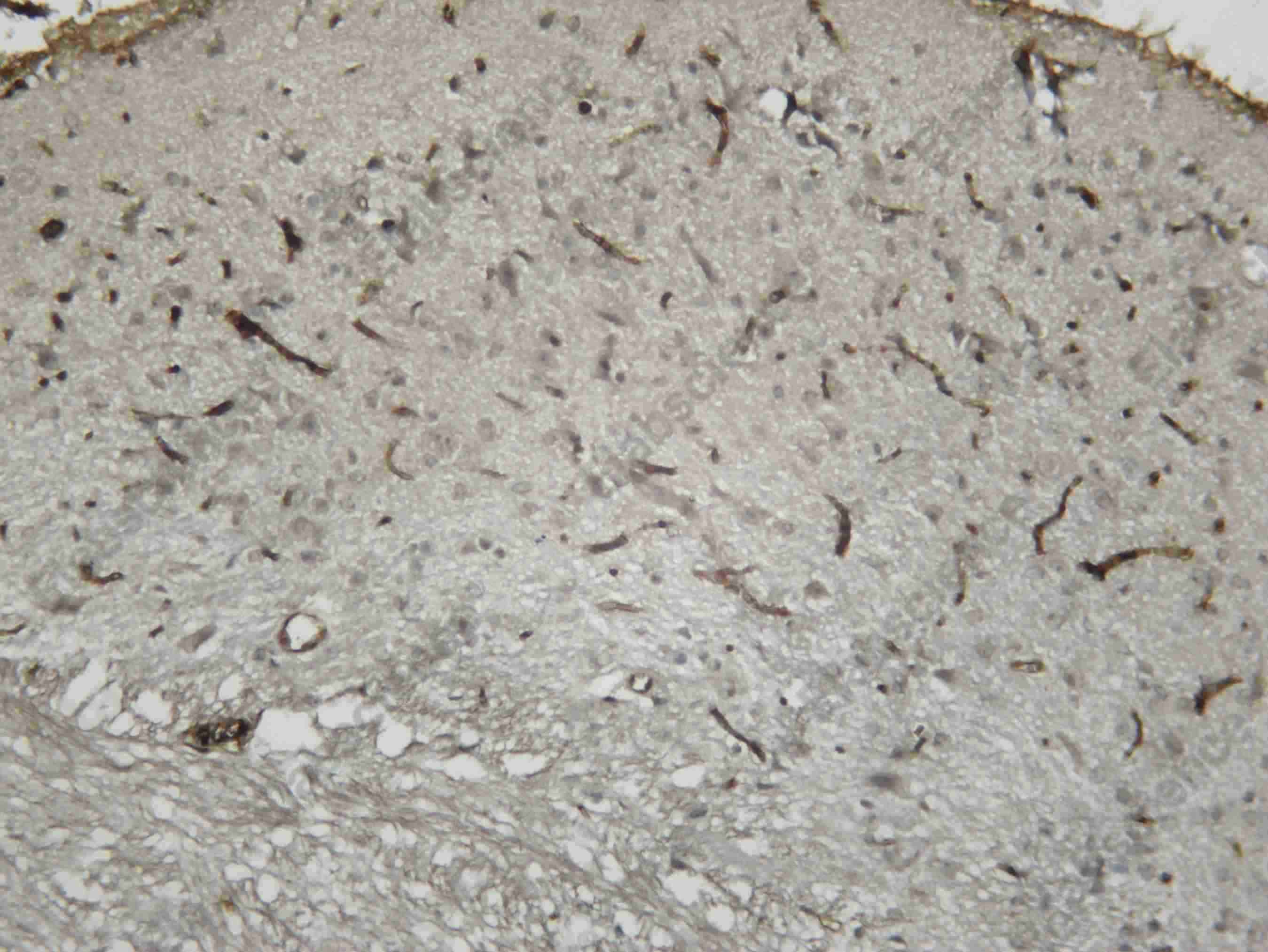 Recombinant C3 Monoclonal Antibody - 3