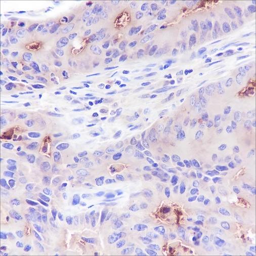 Recombinant CEACAM1 Monoclonal Antibody - small - 2
