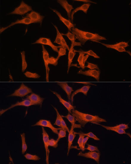 Immunofluorescence analysis of HeLa cells using LGMN Polyclonal Antibody at dilution of  1:100 (40x lens). Blue: DAPI for nuclear staining.