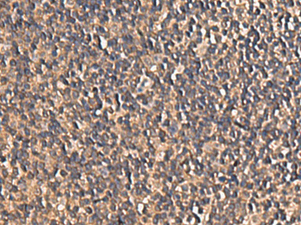 Immunohistochemistry of paraffin-embedded Human tonsil tissue  using PLEKHF2 Polyclonal Antibody at dilution of 1:85(?200)