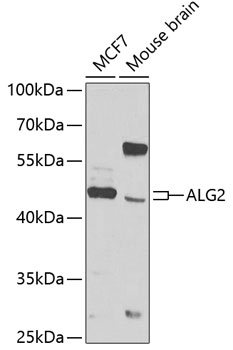 Western blot analysis of extracts of various cell lines using ALG2 Polyclonal Antibody at 1:1000 dilution.