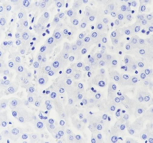 Recombinant Creatine kinase B type Monoclonal Antibody - small - 5