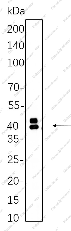 Recombinant Phospho-Erk 1, 2 (Thr202, Tyr204) Monoclonal Antibody - 1