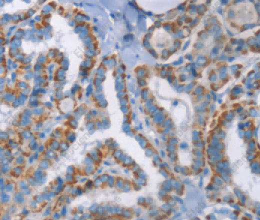 GPA33 Polyclonal Antibody - 3