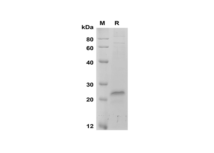 Recombinant Mouse IFN-γ Protein(GST Tag)-产品推荐-1